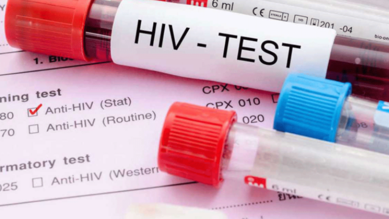 Dünya AIDS Günü raporu: Bu yıl 38 yeni HIV vakası kaydedildi