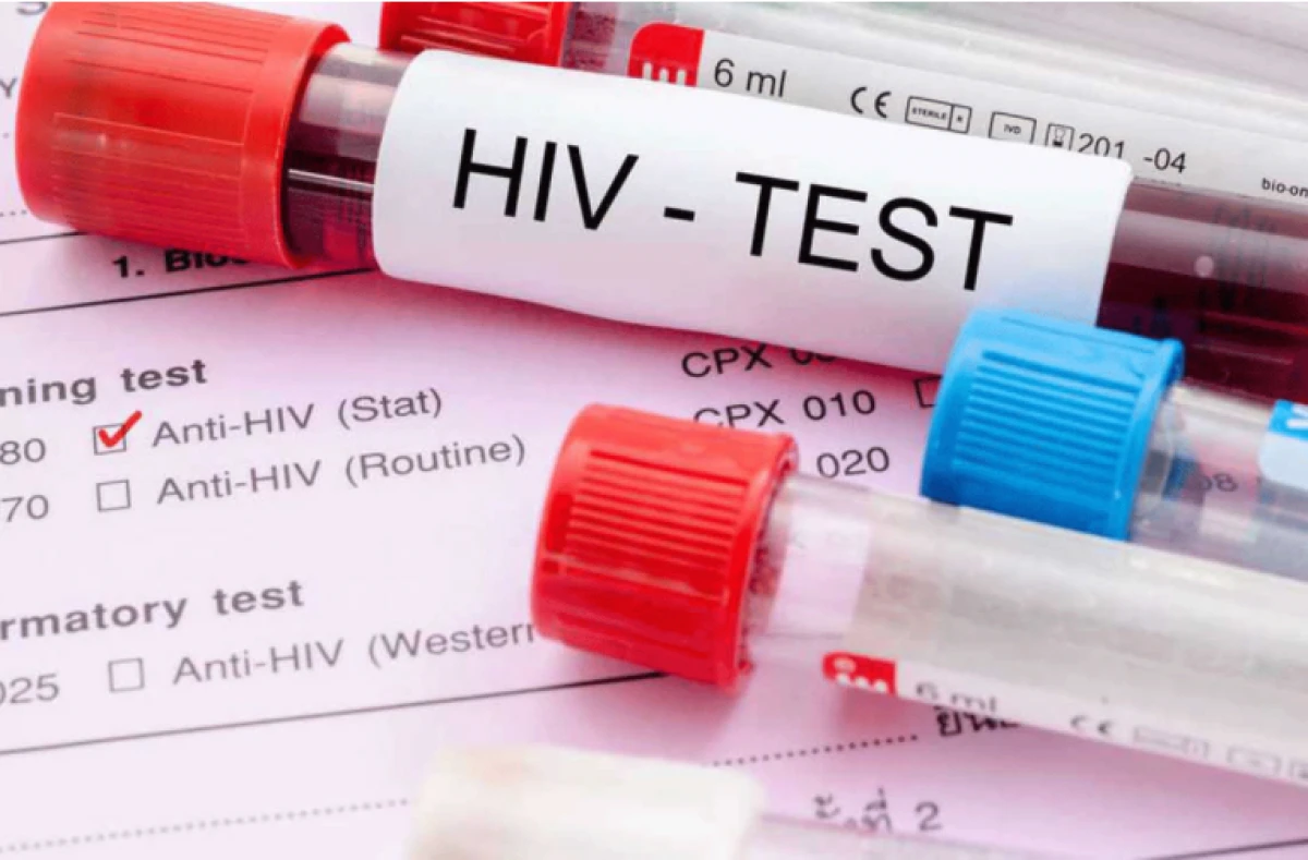HIV vakalarında yeni artış: Temmuz ayında 11 kişi daha kayıtlara ge&ccedil;ti