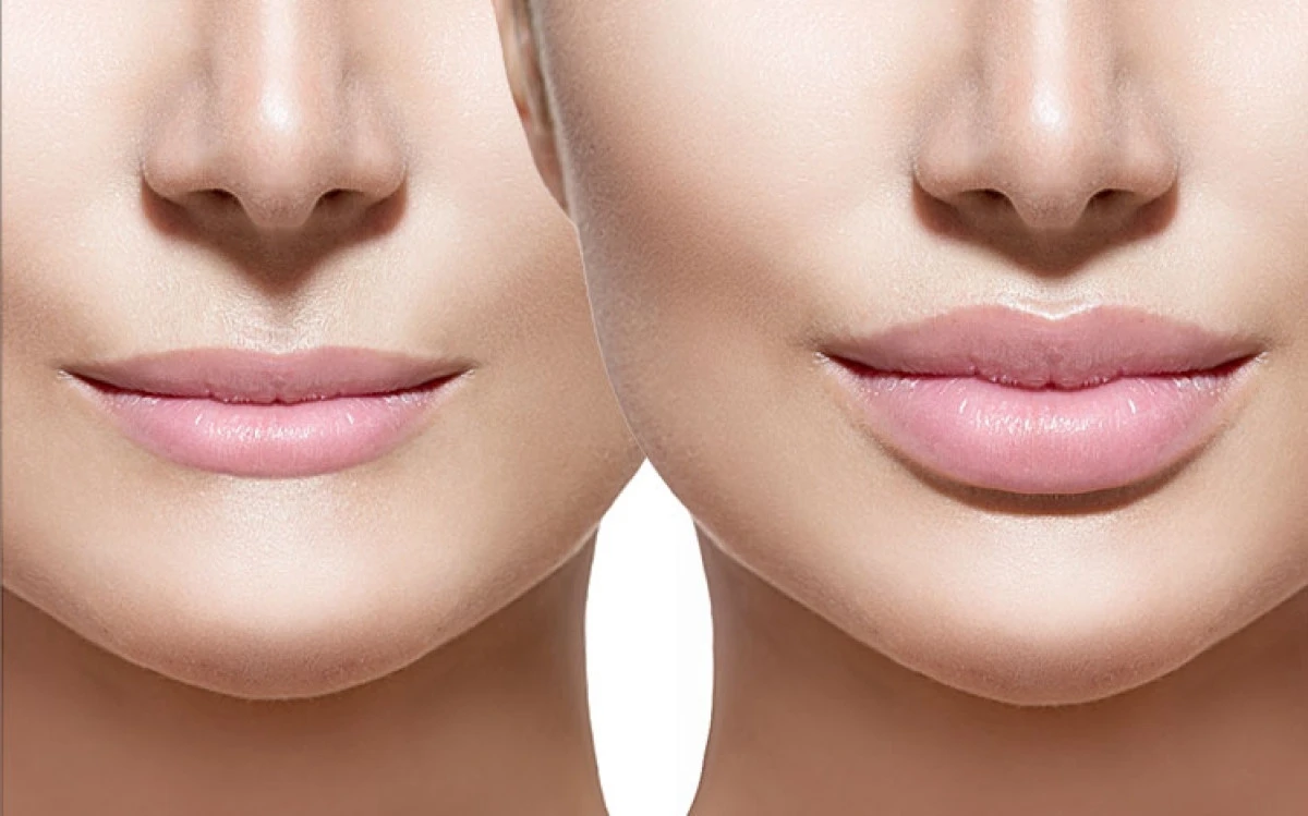 Yasadışı botox ve dolgu operasyonu: İki kişi g&ouml;zaltında, aramalar s&uuml;r&uuml;yor